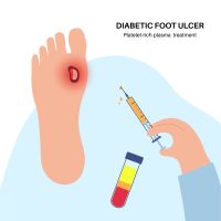 Diabetic Foot Ulcers